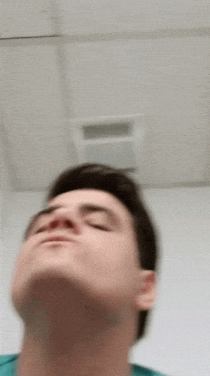 Chin Randall: Blurry Funny Face Close-Up